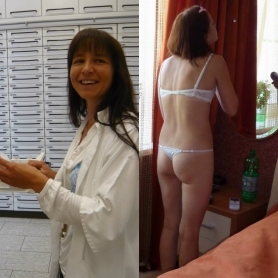 Before _ After - #7