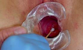 thorough-pussy-examination-of-bodacious-young-brunette